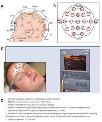What happens in the brain when we die? Deciphering the neurophysiology of the final moments in life